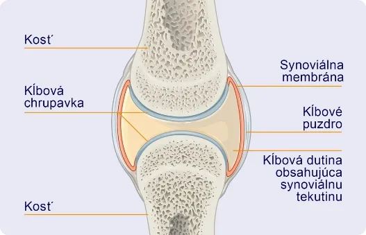 Kĺb s popisom jednotlivých častí: kosť, kĺbové chrupavky, synoviálna membrána, kĺbové puzdro a kĺbová dutina obsahujúca synoviálnu tekutinu
